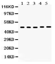 1 - Anti-VDR Picoband Antibody ABO12145