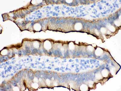 2 - Anti-Villin Picoband Antibody ABO12146