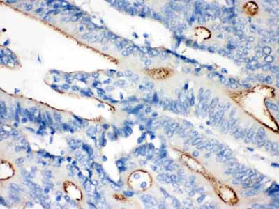 2 - Anti-Villin Picoband Antibody ABO12146