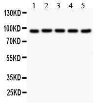 1 - Anti-Villin Picoband Antibody ABO12146
