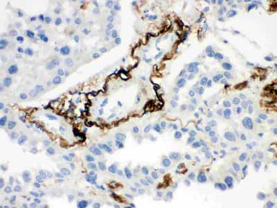 2 - Anti-Vitronectin Picoband Antibody ABO12147