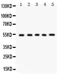 1 - Anti-Vitronectin Picoband Antibody ABO12147