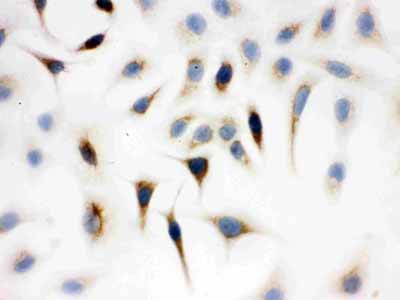 8 - Anti-WASP Picoband Antibody ABO12148