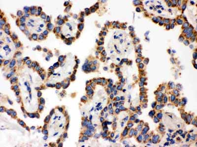 2 - Anti-WASP Picoband Antibody ABO12148