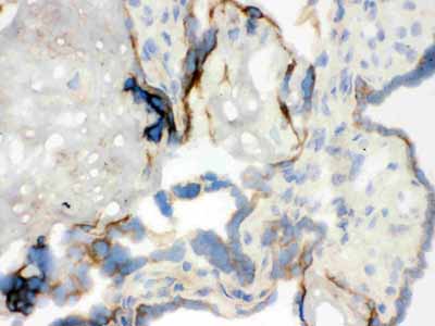 2 - Anti-WASP Picoband Antibody ABO12148