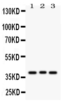 1 - Anti-Wnt2 Picoband Antibody ABO12150
