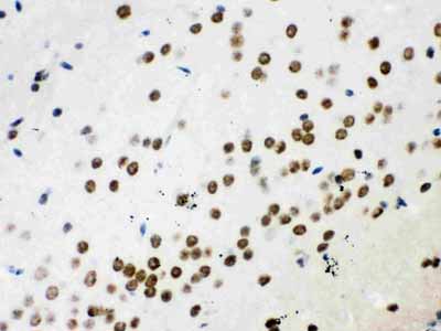 2 - Anti-Wnt2b Picoband Antibody ABO12151