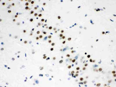 2 - Anti-Wnt2b Picoband Antibody ABO12151