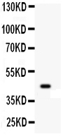 1 - Anti-Wnt2b Picoband Antibody ABO12151