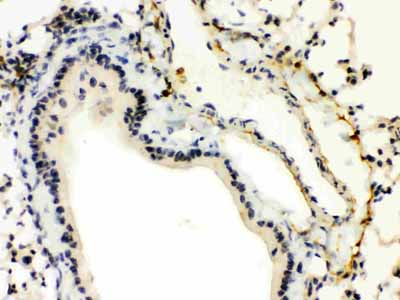 2 - Anti-XBP1 Picoband Antibody ABO12152