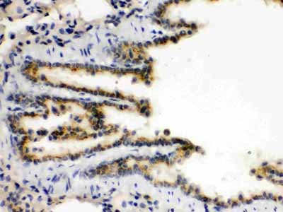 2 - Anti-XBP1 Picoband Antibody ABO12152
