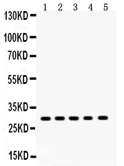 1 - Anti-XBP1 Picoband Antibody ABO12152