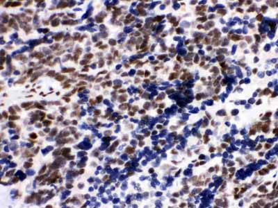 2 - Anti-Ku80 Picoband Antibody ABO12153