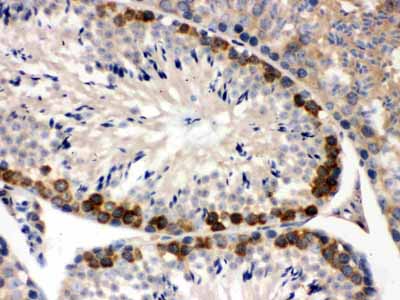 2 - Anti-YB1 Picoband Antibody ABO12154