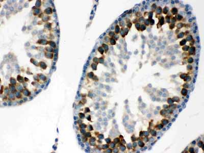 2 - Anti-YB1 Picoband Antibody ABO12154