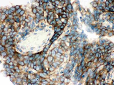 2 - Anti-YB1 Picoband Antibody ABO12154