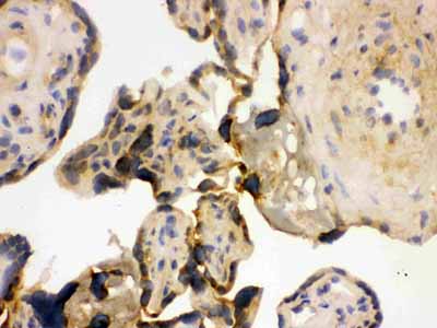 2 - Anti-YB1 Picoband Antibody ABO12154
