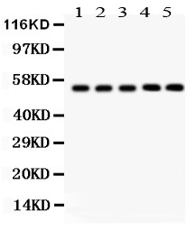 1 - Anti-YB1 Picoband Antibody ABO12154