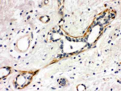 2 - Anti-Yes1 Picoband Antibody ABO12155