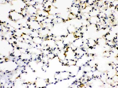 2 - Anti-RAGE Picoband Antibody ABO12158