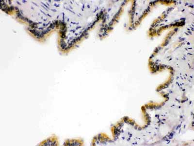 2 - Anti-RAGE Picoband Antibody ABO12158