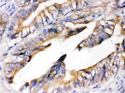 2 - Anti-RAGE Picoband Antibody ABO12158