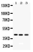 1 - Anti-RAGE Picoband Antibody ABO12158