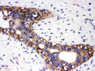 2 - Anti-AGTR1 Picoband Antibody ABO12159
