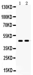 1 - Anti-AGTR1 Picoband Antibody ABO12159