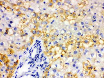 2 - Anti-ALDH2 Picoband Antibody ABO12160