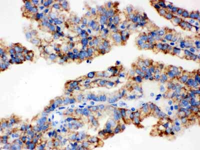 2 - Anti-ALDH2 Picoband Antibody ABO12160