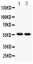 1 - Anti-ALDH2 Picoband Antibody ABO12160
