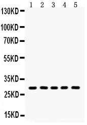 1 - Anti-Aquaporin 1 Picoband Antibody ABO12161