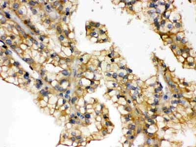 2 - Anti-Aquaporin 2 Picoband Antibody ABO12162