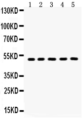 1 - Anti-Aquaporin 2 Picoband Antibody ABO12162
