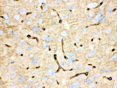 2 - Anti-Aquaporin 4 Picoband Antibody ABO12163