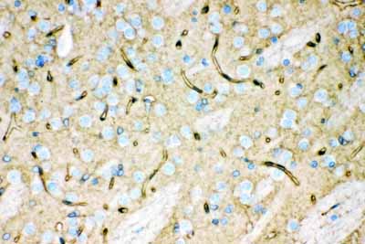 2 - Anti-Aquaporin 4 Picoband Antibody ABO12163