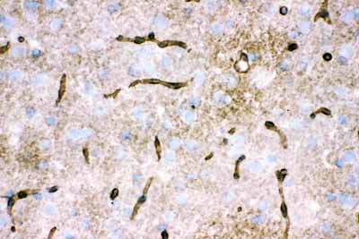 2 - Anti-Aquaporin 4 Picoband Antibody ABO12163