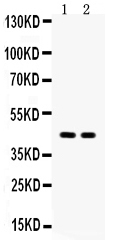 1 - Anti-Aquaporin 4 Picoband Antibody ABO12163