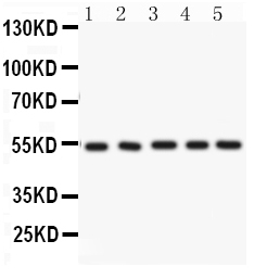 1 - Anti-ARSA Picoband Antibody ABO12165