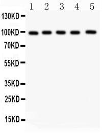 1 - Anti-ASPH Picoband Antibody ABO12166