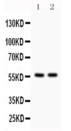 1 - Anti-KIAA0652 Picoband Antibody ABO12168