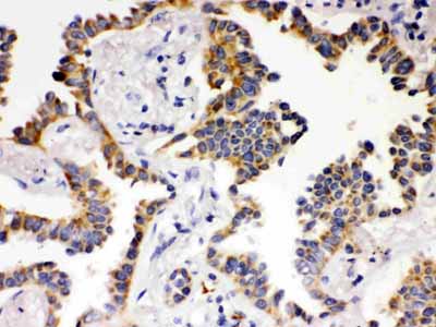 2 - Anti-ATG14L Picoband Antibody ABO12169