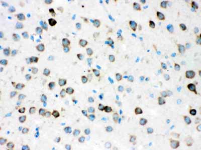 2 - Anti-ATX2 Picoband Antibody ABO12171