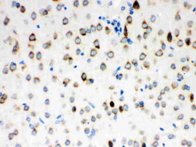 2 - Anti-ATX2 Picoband Antibody ABO12171