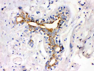 2 - Anti-ATX2 Picoband Antibody ABO12171