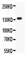 1 - Anti-ATX2 Picoband Antibody ABO12171