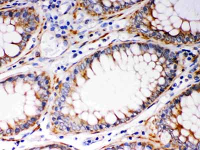2 - Anti-BAK Picoband Antibody ABO12172