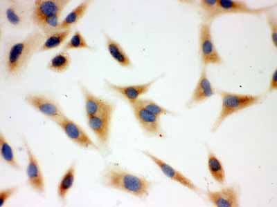 2 - Anti-BAK Picoband Antibody ABO12172