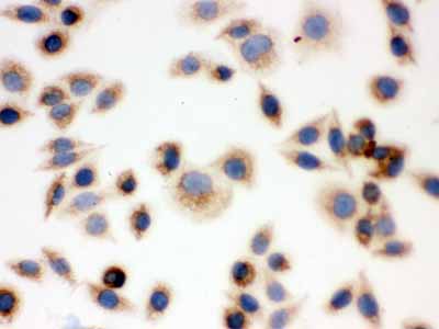 2 - Anti-BAK Picoband Antibody ABO12172